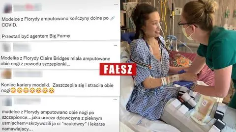 Modelka z Florydy "zaszczepiła się i straciła obie nogi"? To nieprawda, powód był inny
