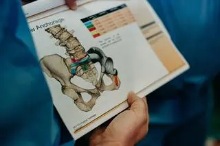 Po usunięciu guza pacjentce wszczepiono implant 3D