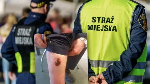 Agresywny mężczyzna "boleśnie" ugryzł strażnika w łydkę 