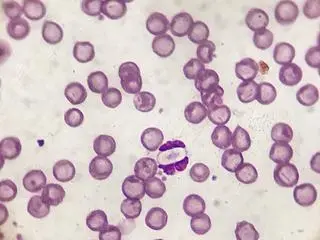 Pasożytniczy pierwotniak Hepatozoon canis