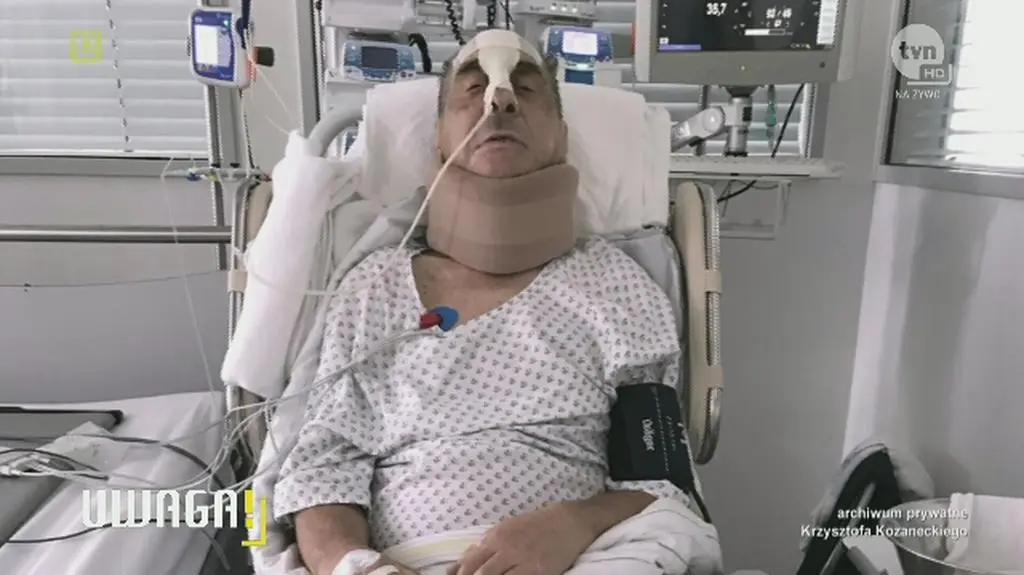 Popękały mu kręgi twarz miał połamaną zniekształconą