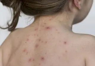 Groźny wirus na Podkarpaciu. Wzrosła liczba zakażeń