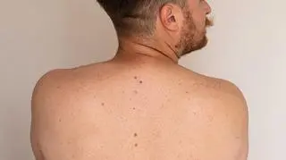 dermatolog shutterstock_2827870019