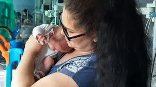Lekarze uratowali dziecko, które urodziło się z guzem ważącym ponad 3 kg