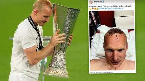 Brutalny faul i siedem szwów na czole, a jemu w głowie tylko puchar