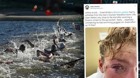 "Myślałem, że wypadło mi oko". Bolesny cios w wodzie