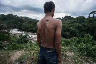 Honduras: obrońca środowiska z blizną po ranie na plecach