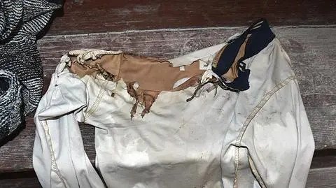 "Cała twarz i szyja mężczyzny zajęte były ogniem". 26-latka z zarzutem za podpalenie swojego partnera