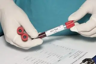 Wirus HIV