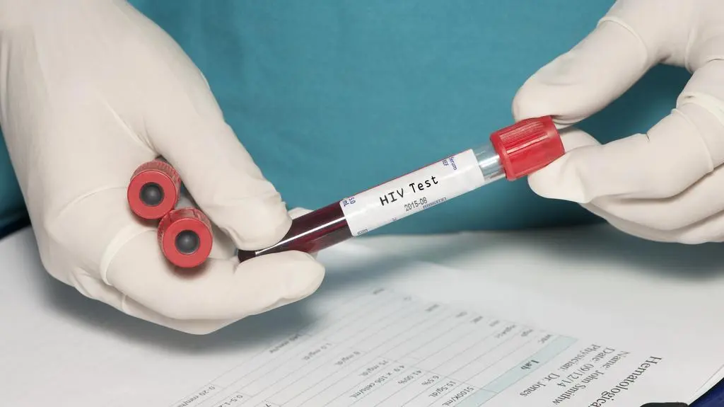Wirus HIV