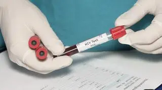 Wirus HIV