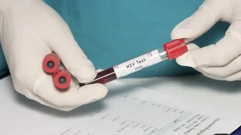 Wirus HIV