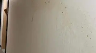 fekalia piksel