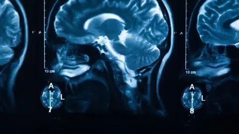 Skan obrazu radiologicznego ludzkiego mózgu