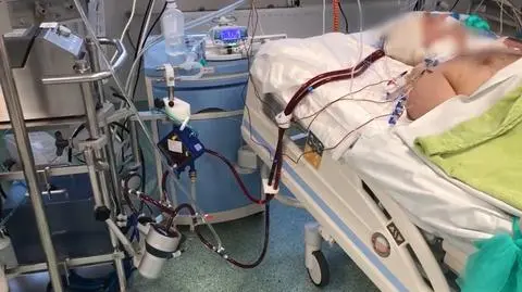 ECMO to "ostatnia deska ratunku" dla pacjentów, którzy nie są w stanie oddychać