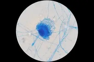 Aspergillus terreus w laboratorium - zdjęcie ilustracyjne