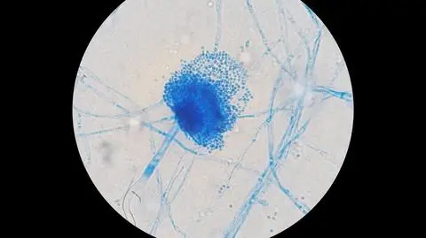 Aspergillus terreus grzyb grzyby shutterstock_2051126426