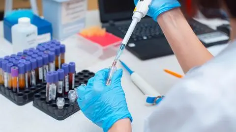 Coraz mniej osób bada się w Polsce na HIV
