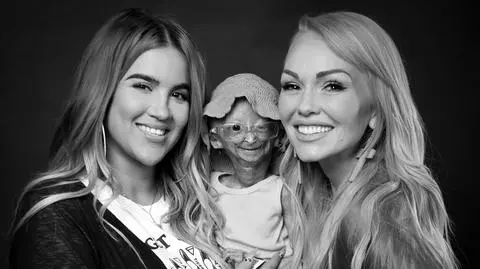 Adalia Rose Williams nie żyje. Nastoletnia youtuberka zmagała się z rzadkim schorzeniem