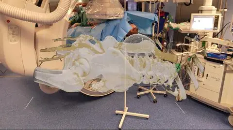 Hologram stanowi odwzorowania anatomii pacjenta