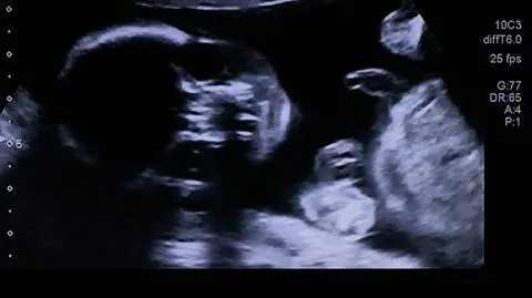 Cząstki sadzy znalezione w krwi pępowinowej i w narządach płodów. "To szczególnie niepokojące"