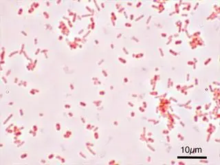 Pałeczki salmonella typhi