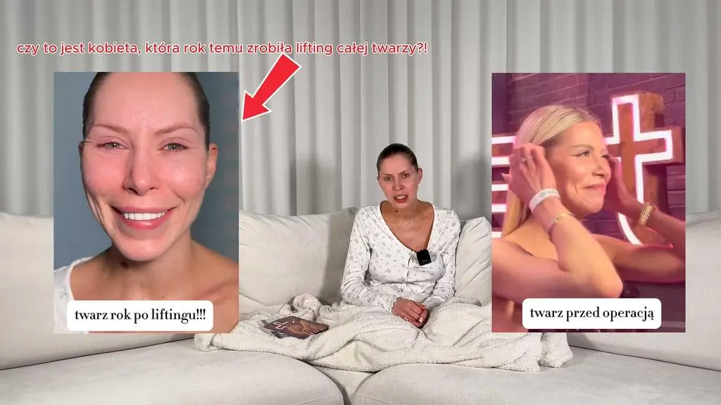 Julia von Stein o swojej "nieudanej" operacji twarzy opowiedziała w prawie godzinnym filmie "Spowiedź"