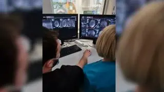 Nowatorska operacja usunięcia guza mózgu w Centrum Zdrowia Dziecka