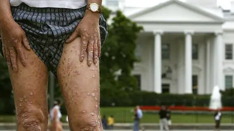 Agent Orange. Pomarańczowy zabójca