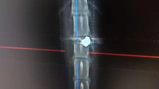 Kotka przeszła operację usunięcia śrutu z okolic kręgosłupa