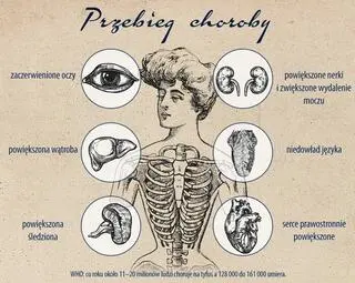 Jak tyfus wpływa na organizm człowieka?