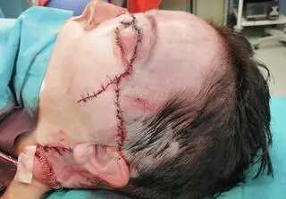 Operacja zakończyła się sukcesem