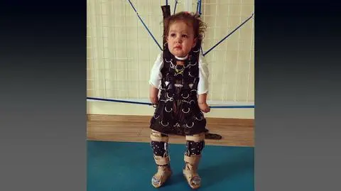 "Lekarz, który prowadził moją ciążę, zataił to". Amelka nie może sama zginać nóżek ani rączek