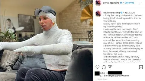 Projektant Olivier Rousteing pokazał zdjęcie w bandażach