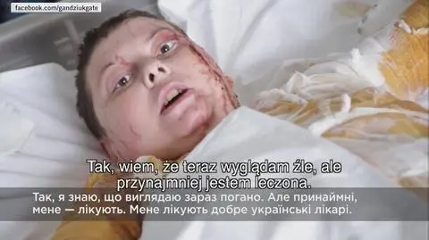 Wyglądam źle ale przynajmniej jestem leczona