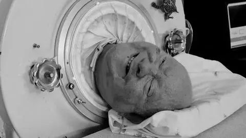 Zmarł Paul Alexander. Przez 70 lat "żył w żelaznym płucu"