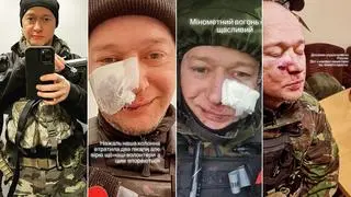 Andrij Chływniuk został ranny w walkach pod Kijowem
