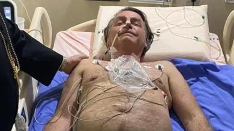 Problemy z mówieniem i chroniczna czkawka. Prezydent Brazylii trafił do szpitala