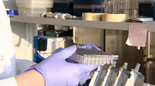 W Instytucie Chemii Bioorganicznej PAN powstał test różnicujący
