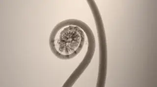 "Pteridophyta"