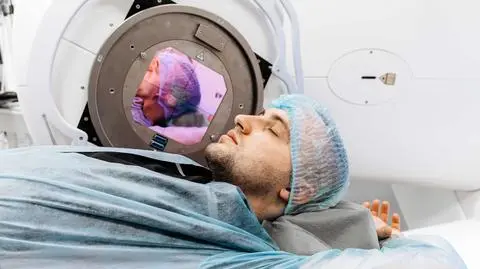 radioterapia shutterstock_2617041335