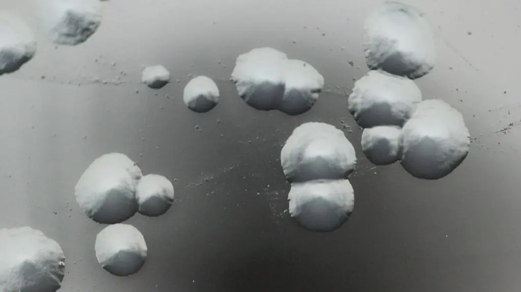 Legionella