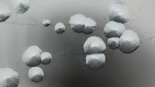 Legionella