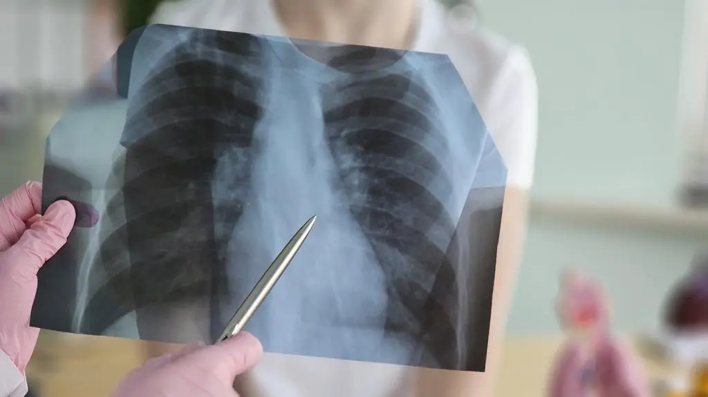 RTG diagnostyka lekarz  shutterstock_2725027663