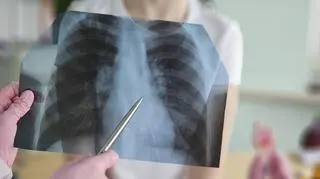 RTG diagnostyka lekarz  shutterstock_2725027663