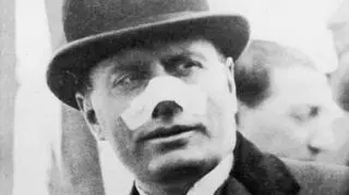 1926 rok, Benito Mussolini z opatrzonym nosem