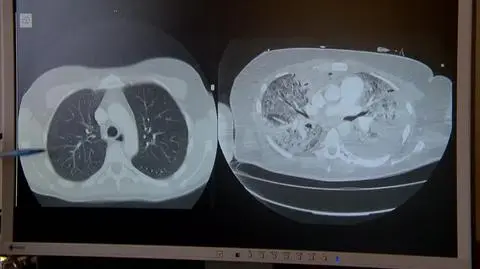 2203N387XR PIS DNZ WILCZYNSKA