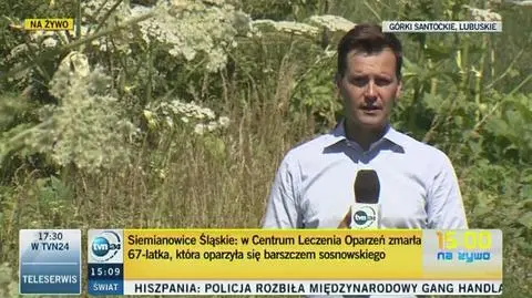 Objawy oparzenia mogą być widoczne po kilku dniach