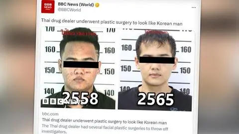 Operacje plastyczne miały dać mu wolność. "Z jego prawdziwej twarzy nic nie zostało"