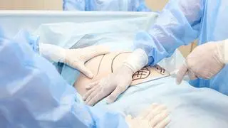Zabiegi, którym zagrożone osoby poddały się w meksykańskich klinikach, to m.in. liposukcja i lifting pośladków
